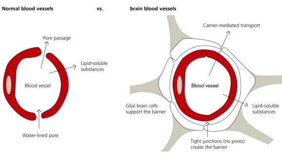 A comparison of a normal blood vessel and brain blood vessel