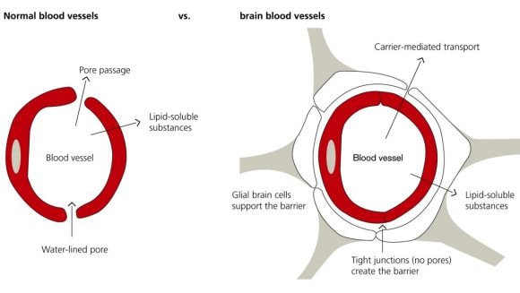 A comparison of a normal blood vessel and brain blood vessel